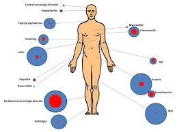 Investigating The Side Effects Of Cancer Immunotherapy National Cancer Institute