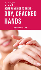 Dry Cracked Hands Remedies Causes And Prevention Tips Dry Cracked Hands Cracked Hands Dry Cracked Hands Remedy