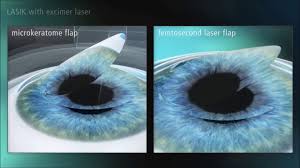 How long should i wait to get lasik eye surgery? Dallas Lasik Eye Surgery Cost 214 328 0444 Lasercare Eye Center