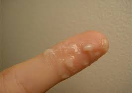 A thick white discharge is a normal occurrence, but there are times when you may be worried. Cervical Mucus Signs You Re Most Fertile Photos Babycenter