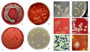 Eu am urmat tratament cu antibiotice pe baza de antibiograma, la salut masinameaata. Stafilococ Auriu Wikiwand
