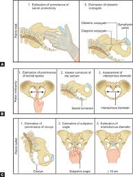 Image result for Pelvimetry