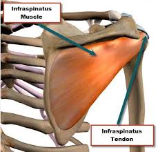 After passing over the glenohumeral joint it inserts onto. Infraspinatus Tendon Tear
