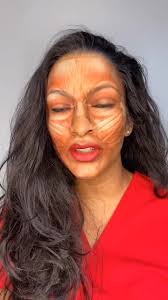 Understanding Gummy Smile Treatment Through Muscle Anatomy