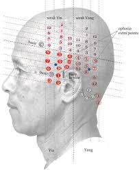 Yamamoto New Scalp Acupuncture Ynsa Development