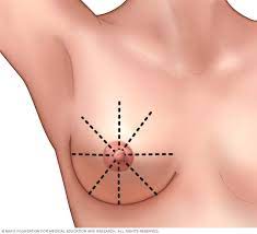 Even if it does turn out to be nothing, it would still have. Breast Cancer Symptoms And Causes Mayo Clinic