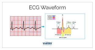 Image result for R Wave