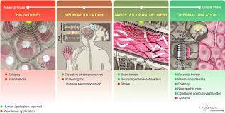 Current And Future Clinical Applications Of Focused Ultrasound Fus Download Scientific Diagram