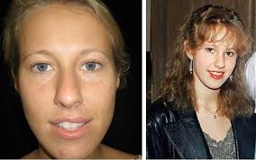 Kseniya Sobchak Do I Posle Plastiki Do Posle Yandeks Dzen