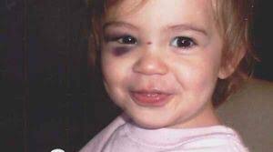 Child Abuse: Documented, substantiated, so why not prosecuted?