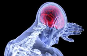 Brain Aneurysm Symptoms Causes Treatment Medicine Prevention Diagnosis Read about brain aneurysm treatment, recovery, surgery, causes, symptoms, survival rates, rupture, and prevention.