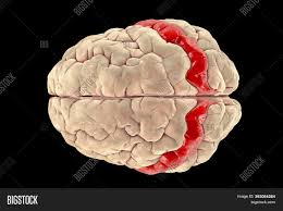 Area 3 is responsible for receiving the bulk of the input that comes straight from the thalamus. Human Brain Image Photo Free Trial Bigstock