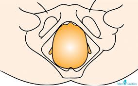 The op is wrong, what we need to do. Occiput Posterior Does It Affect Labor And How To Manage It