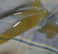 8 tanda air ketuban merembes sebenarnya sangat mudah dideteksi, air ketuban berwarna bening agak (baca juga: Keluar Cairan Bening Saat Hamil 9 Bulan