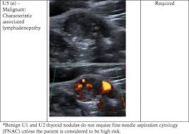25% (follicular and medullary) hyperechoic solid nodule: Ultrasonography Of Thyroid Nodules A Pictorial Review Springerlink