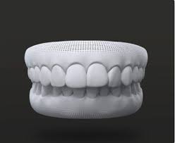 Invisalign treatment is the clear alternative to metal braces for kids, teens, and adults. Invisalign Go Invisalign Provider
