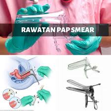 Pap smear juga dikenal dengan pap test atau papanicolao test karena. Ha Apa Tu Ujian Pap Smear Wanita Wajib Tahu Untuk Bantu Cegah Kanser Di Peringkat Awal Manis Madu