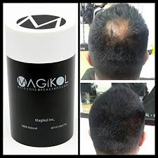 The Best Rated 100 Vegan Natural Hair Loss Treatment For Men Women Dark Brown Magikol 100 Hair Building Fibers Concealer Makes Thinning Hair Thickener 5 Week Supply Buy Online