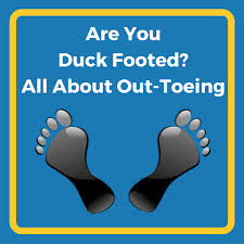 Image result for Out-toeing