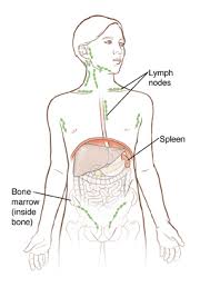 While bone pain is the main symptom of bone cancer, and pain in the hip bone can be an indication of a tumor in the hip, there are often more likely other explanations for hip pain. When Your Child Has Hodgkin Lymphoma Saint Luke S Health System