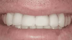 We can get you into a dentist when no one else can! Dentist Orlando Florida Cosmetic Preventive Restorative Dental Center