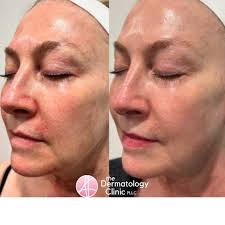 The Dermatology Clinic