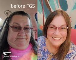 My 100-Pound Weight Loss Journey: 225lbs to 125lbs