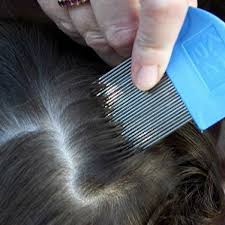 Doctors Won T Tell You This Cheap Way To Get Rid Of The Head Lice Almost Instantly Head Louse Lice Shampoo Lice Remedies