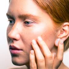 Helia Glow Apple Stem Cell Firming Serum Helia Glow Apple Stem Cell Fi