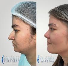 𝘑𝘢𝘷𝘪𝘦𝘳 𝘉𝘳𝘪𝘰𝘯𝘦𝘴 𝘐𝘨𝘭𝘦𝘴𝘪𝘢𝘴 𝘊𝘪𝘳𝘶𝘫𝘢𝘯𝘰  𝘗𝘭𝘢́𝘴𝘵𝘪𝘤𝘰 𝘊𝘪𝘵𝘢𝘴 𝘢𝘭 W𝘩𝘢𝘵𝘴𝘈𝑝𝑝 0985073748  𝘗𝘰𝘳𝘵𝘰𝘷𝘪𝘦𝘫𝘰- 𝘌𝘤𝘶𝘢𝘥𝘰𝘳