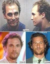 Parliamo dei nomi di hollywood e non solo: Trapianto Capelli Vip Matthew Mcconaughey Clinica Pallaoro
