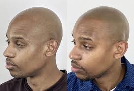 Anna Burns Permanent Cosmetics