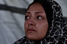 The two sick siblings: Abdullah Abu Zarqa, 5 years old, has been suffering  from osteomalacia and osteoporosis for two years, causing hair loss,  vitamin D deficiency, and difficulty breathing. She also suffers