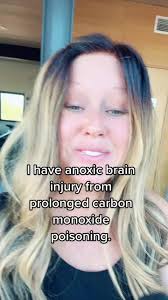 Connieprogress Anoxic Brain Injury