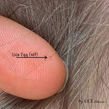 Synthetic fibers can be knit and woven similarly to natural fibers. Dead Vs Live Nits Color Of Lice Eggs My Lice Advice
