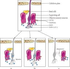 Image result for Drug-Induced Olfactory Dysfunction