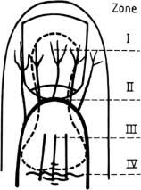 It is a simple technique, without the need … The Palmar Pocket Method An Adjunct To The Management Of Zone I And Ii Fingertip Amputations Journal Of Hand Surgery