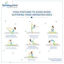 Butterfly pose may be a simple exercise, but it has a lot of benefits, especially for pregnant women. Yoga Postures To Avoid When Suffering From Herniated Discs