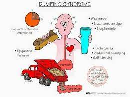 Dumping syndrome, which may occur after operations in which part or all of the stomach is removed or after gastric bypass operation, can be defined as a symptom characterized by rapid emptying of the stomach. Facebook