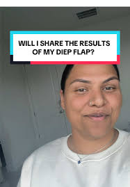 Vacation After Diep Flap