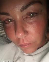 Michelle Heaton shares teary photo at the height of her alcohol addiction  battle as she reflects