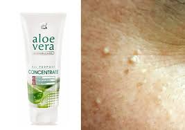 Lr Ile Yag Bezelerine Etkili Cozum Lr Urunleri Aleo Vera Aloe Vera Aloe