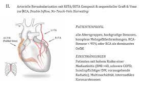 De acvb behartigt de belangen van al deze vrijwillige medewerkers. Bypass Chirurgie Grosstes Kommunales Krankenhaus In Nrw