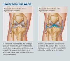 Pin On The Knee Joint