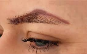 Some have utilized aldara or alphahydroxyacid in combination with laser which apparently helped the treatment. Tatto Removal Perth Eyebrow Tattoo Removal Tattoo Removal Price