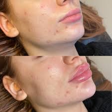 Anyone have any filler deals