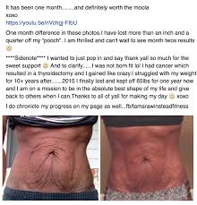 Loose Skin Here S Just One Of The Incredible Things The Fasciablaster Can Do This Is Another Amazing Work Of Art Fascia Blaster Loose Skin Fascia Blasting
