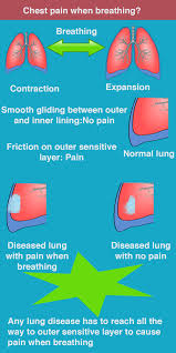 Having Chest Pain When Breathing In
