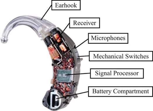 Components of a common behind the ear hearing aid device [11]. | Download Scientific Diagram