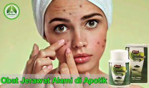 Kini Telah Hadir Obat Jerawat Alami Di Apotik Yang Telah Terbukti Dapat Mengatasi Jerawat Dengan Cepat Dan Tentunya Aman Segera Pe Obat Jerawat Jerawat Herbal